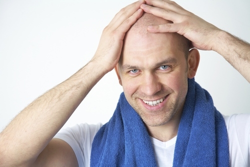 hair loss treatment 